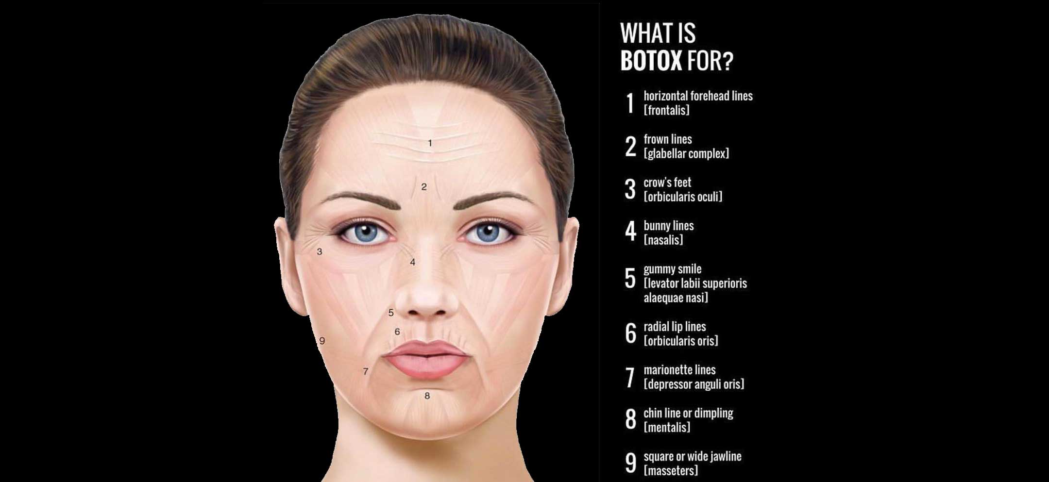 Botox Cosmetic Nashville - Neuromodulators Franklin - Skin Procedures Mt Juliet